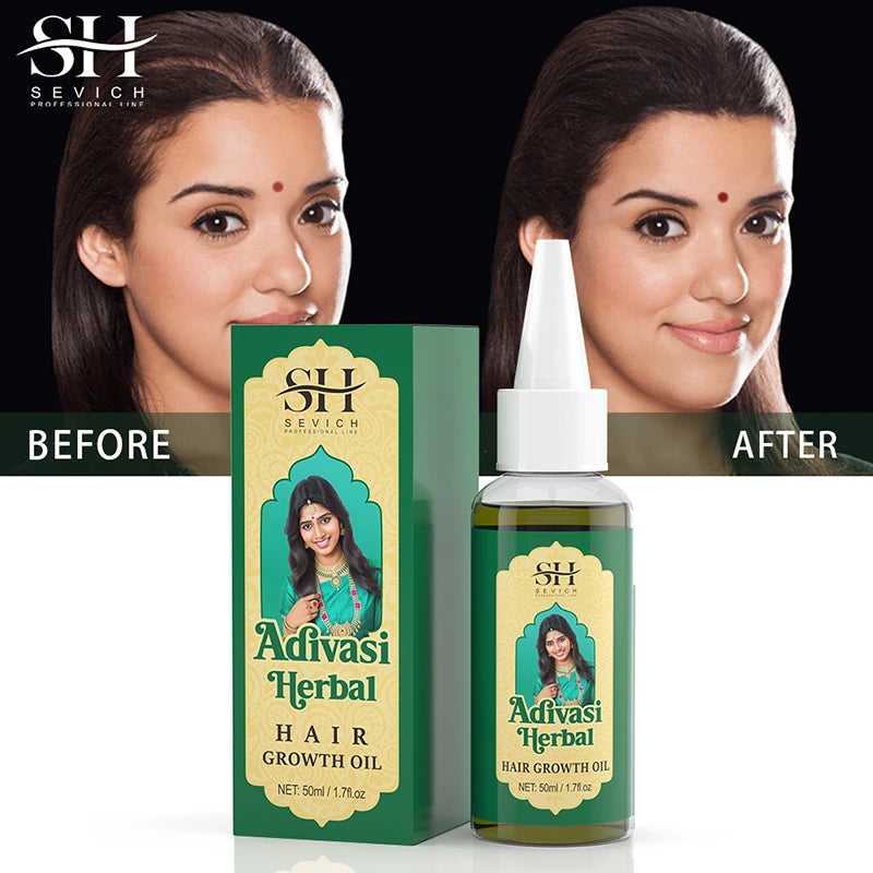 22‑Herb Ayurvedic Hair Oil (Coconut Base)
